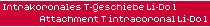 Intrakoronales T-Geschiebe LiDo1 - Attachment T intracoronal LiDo1